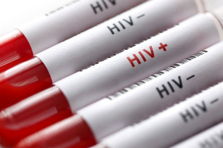 آیا درمان قطعی برای ایدز وجود دارد؟