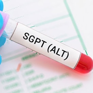 آزمایش SGPT یا ALT چیست ؟