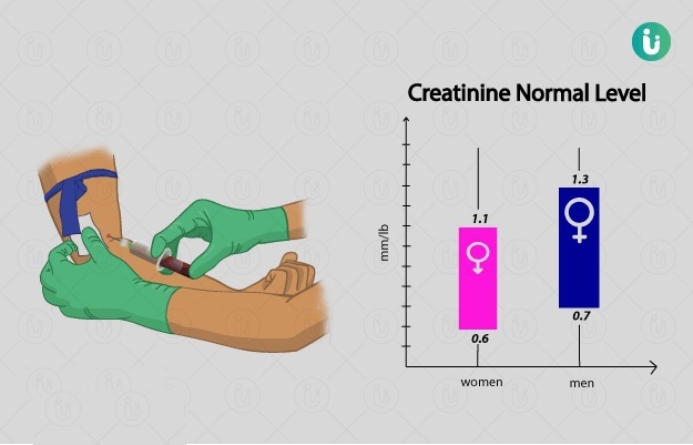 آزمایش Creatinine چیست؟