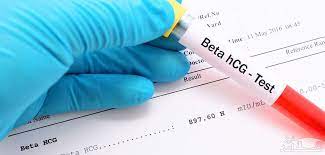 آزمایش Beta HCG