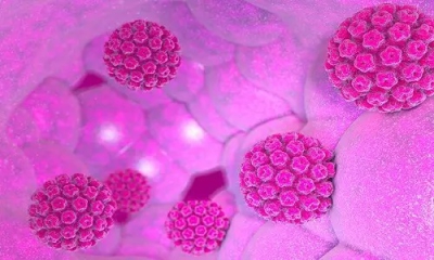 ویروس اچ پی وی و خطر ابتلا به سرطان در زنان