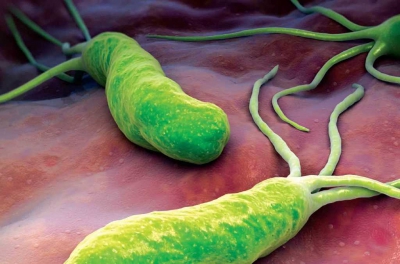 درمان مشکلات معدی و گوارشی ناشی از میکروب هلیکوباکتر چیست؟