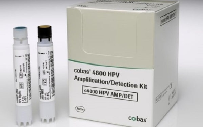 خصوصیات تست Cobas HPV برای تشخیص HPV