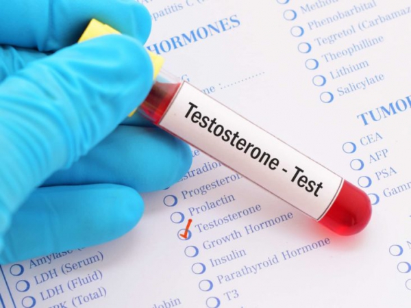 تستوسترون چیست و نشانه های کمبود تستوسترون درمردان چیست؟