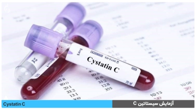 سیستاتین C چیست و در چه مواردی استفاده میشود؟